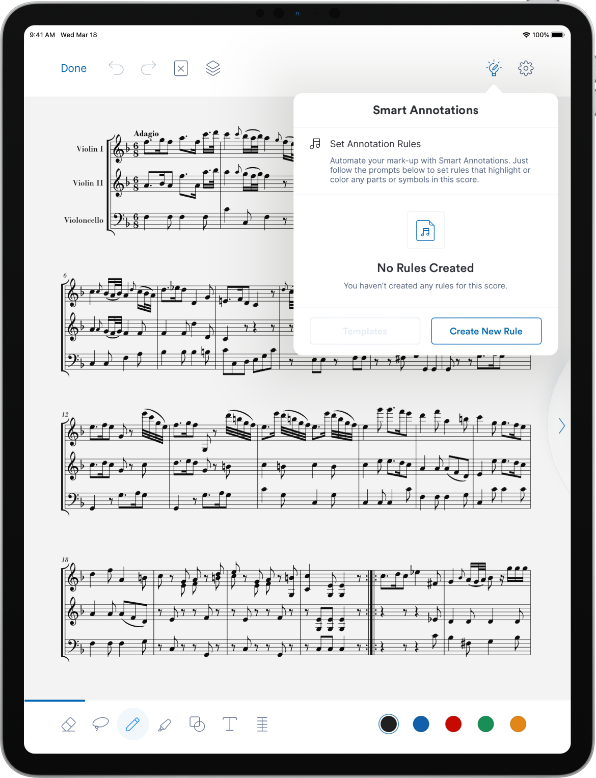 29 empty Smart Annotations.png