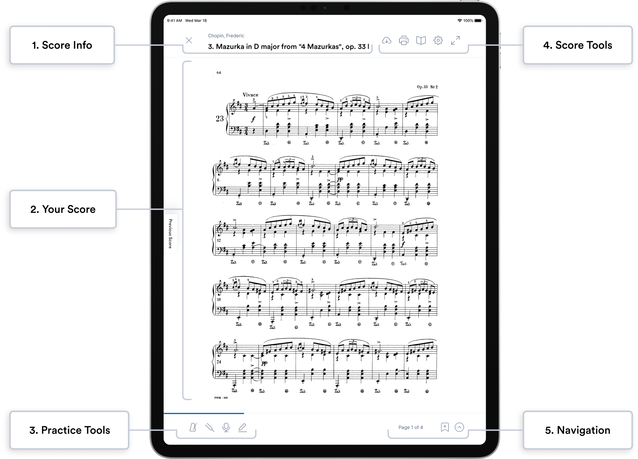 Score View (markup).png